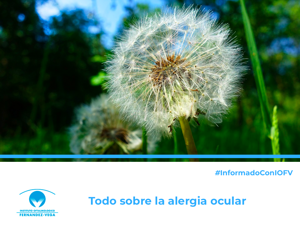 Alergia ocular: tipos de alergias en los ojos y cómo prevenirlas