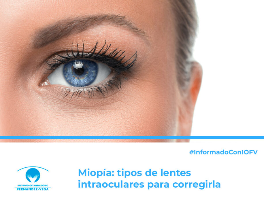 Miopia:Tipos de lentes intraoculares para corregirla