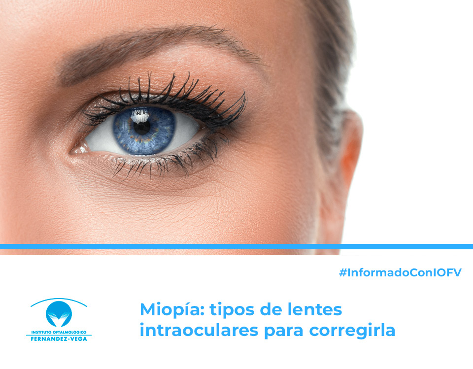 Miopía: tipos de lentes intraoculares para corregirla