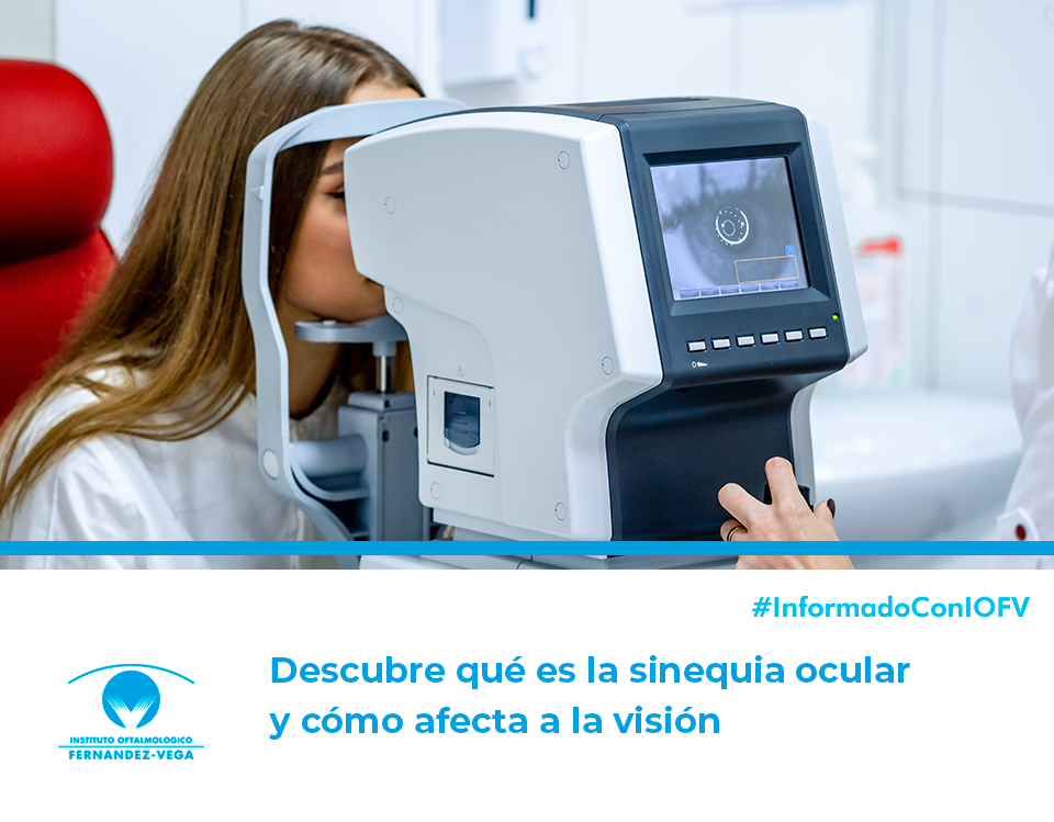 Descubre qué es la sinequia ocular y cómo afecta a la visión