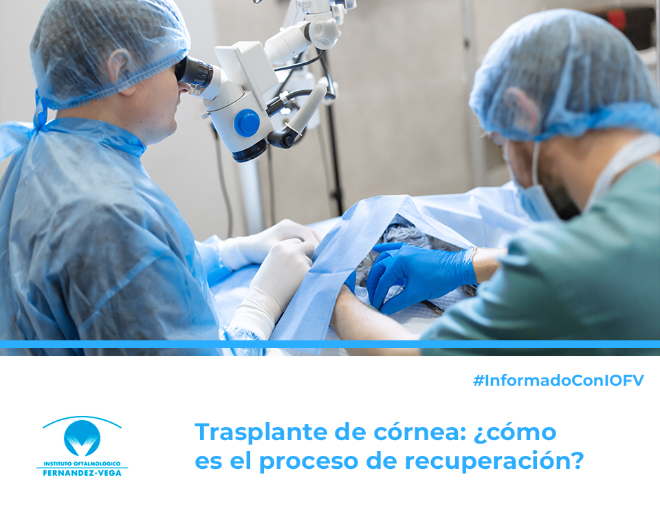 Trasplante de córnea: ¿cómo es el proceso de recuperación?