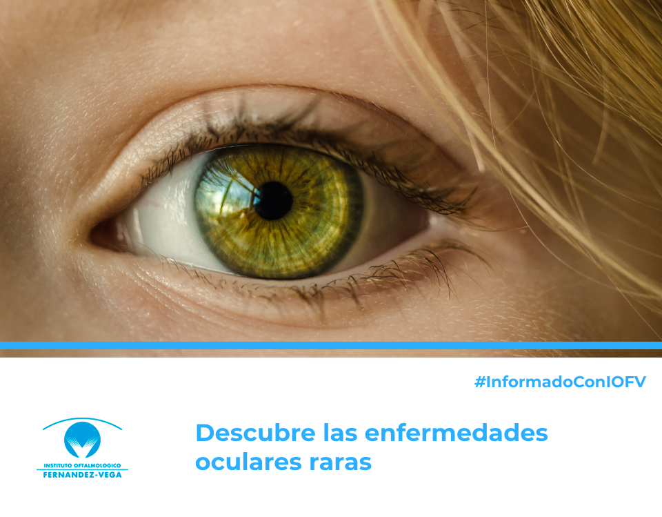Descubre las enfermedades oculares raras: Uveítis, retinosis pigmentaria y más