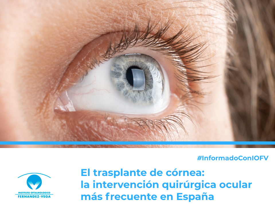El trasplante de córnea: la intervención quirúrgica ocular más frecuente en España
