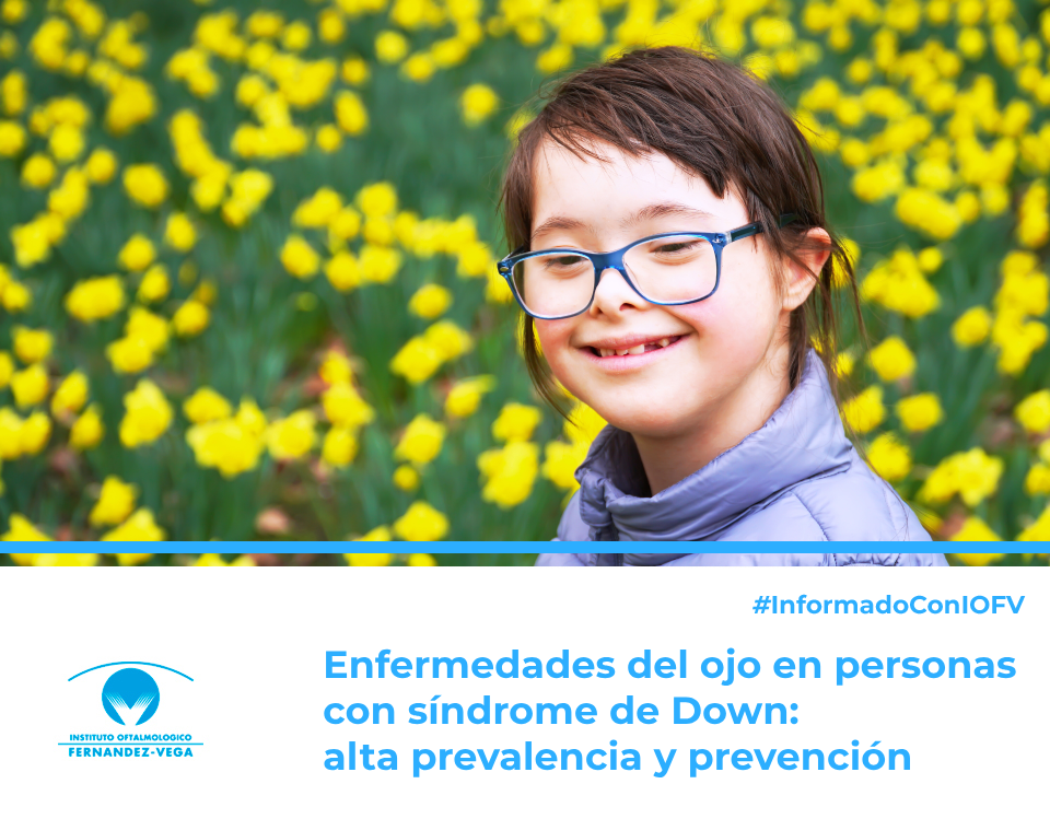 Enfermedades del ojo en personas con síndrome de Down: alta prevalencia y prevención